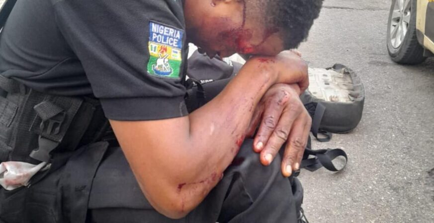 NIGERIANS SHOW LOVE TO A POLICE OFFICER INJURED BY A HIT AND RUN