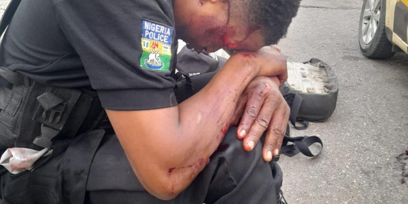 NIGERIANS SHOW LOVE TO A POLICE OFFICER INJURED BY A HIT AND RUN
